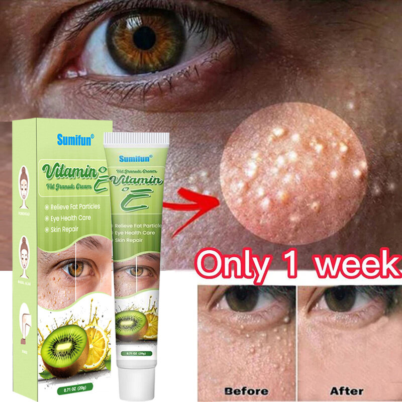 Crema para Ojos eliminadora de gránulos de grasa, producto para reparación y cuidado de la piel de los ojos, elimina eficazmente la hinchazón, antipartículas