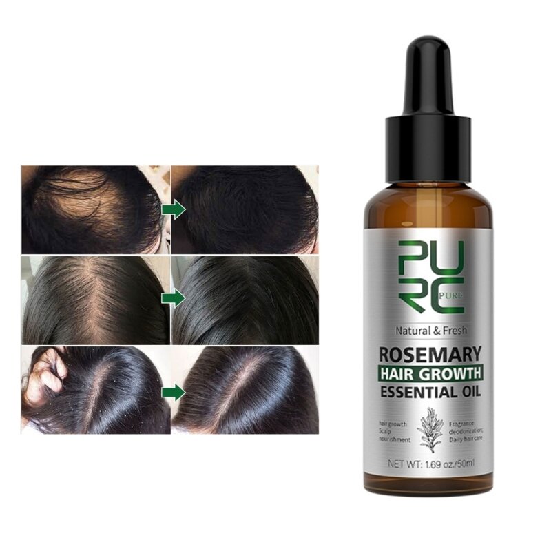 Aceite de romero para el crecimiento del cabello, aceite esencial refrescante y nutritivo para el crecimiento del cabello, envío