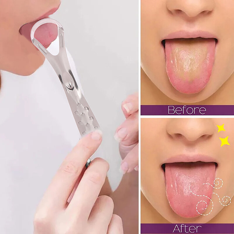 Pembersih Lidah tipe terbuka antiselip, pembersih lidah baja tahan karat dapat digunakan kembali, kebersihan mulut sehat