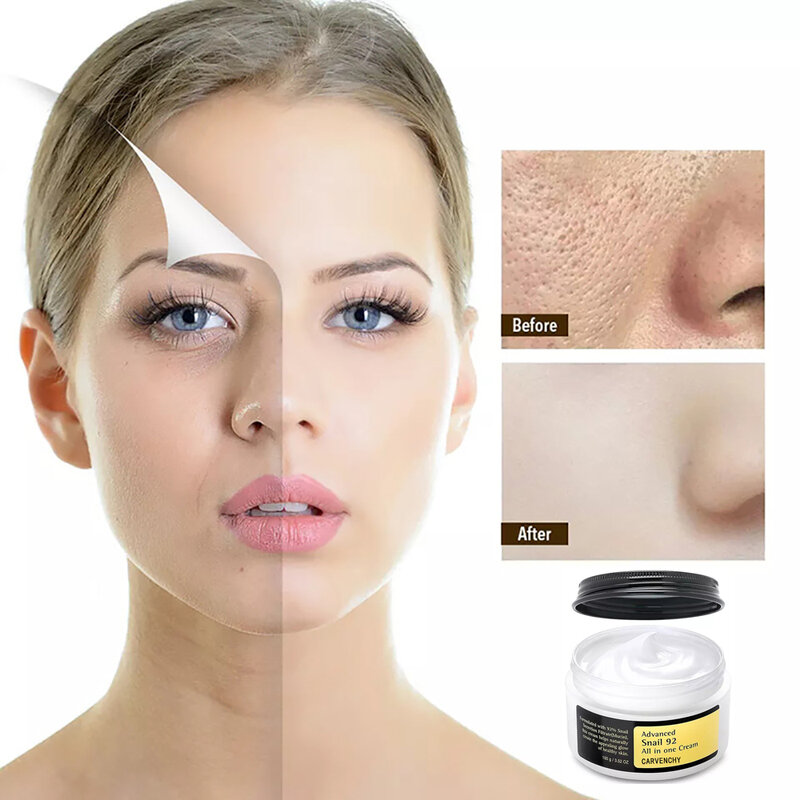 Cosrx Schnecken mucin Feuchtigkeit creme, tägliche Reparatur Gesichts gel creme für trockene haut empfindliche Haut koreanische Hautpflege