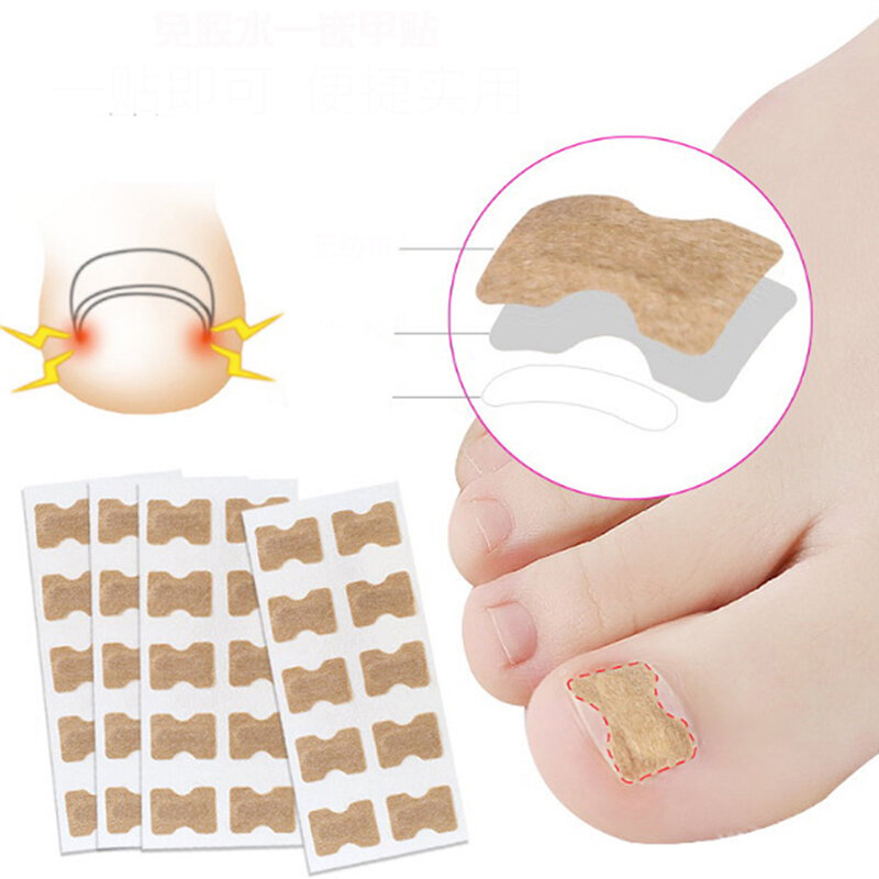 10 sztuk/zestaw naklejek do korekcji paznokci wrastające naszywki z korektorem paznokci do leczenia odzyskują narzędzie do pielęgnacja Pedicure korektora
