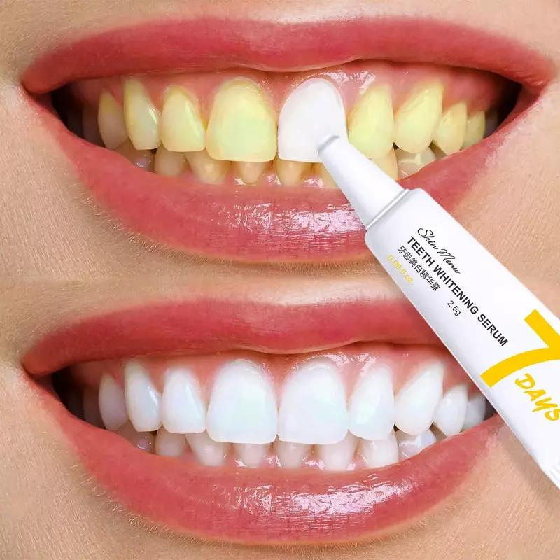 Teeth Whitening Essence Clean Oral Hygiene Whiten Teeth Remove Plaque Stains Fresh Breath Oral Hygiene Oral Care Dental Care Set