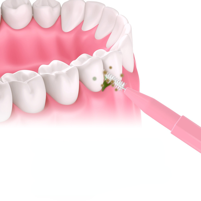 30ชิ้น/เซ็ต I Interdental แปรง Denta Interdental ทำความสะอาดฟันทันตกรรมฟันแปรง Oral Care ยาสีฟันสูตรเกลือผสมฟลูออไรด์ผสานพลังสมุนไพรฟันขาวสะอาดลดกลิ่นปากเครื่องมือ
