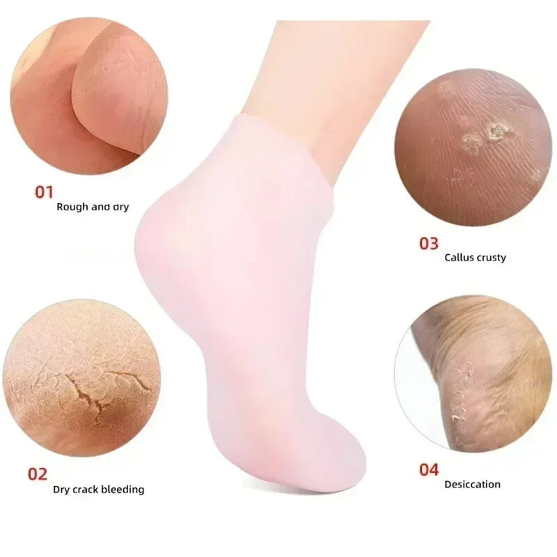 Calcetines de silicona para Spa, guantes de Gel hidratante, calcetín exfoliante, prevención de sequedad, piel muerta agrietada, Protector para el cuidado de las manos y los pies