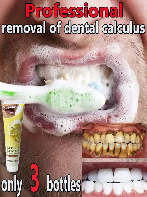ผลิตภัณฑ์ฟอกสีฟันเพื่อขจัดคราบหินปูนและกลิ่นปากหินปูน