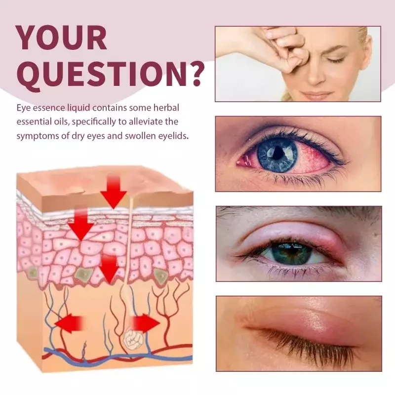 الجمال الطبيعي العين تخفيف المصل ، وتخفيف التعب ، احمرار وتورم التهاب الجفن ، جوهر الرعاية الصحية