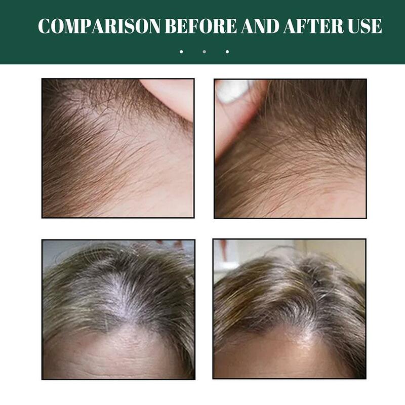 Cairan perawatan rambut esensi jahe, memperbaiki, dan menutrisi, perawatan rambut dan akar Anti rambut rontok B7E1