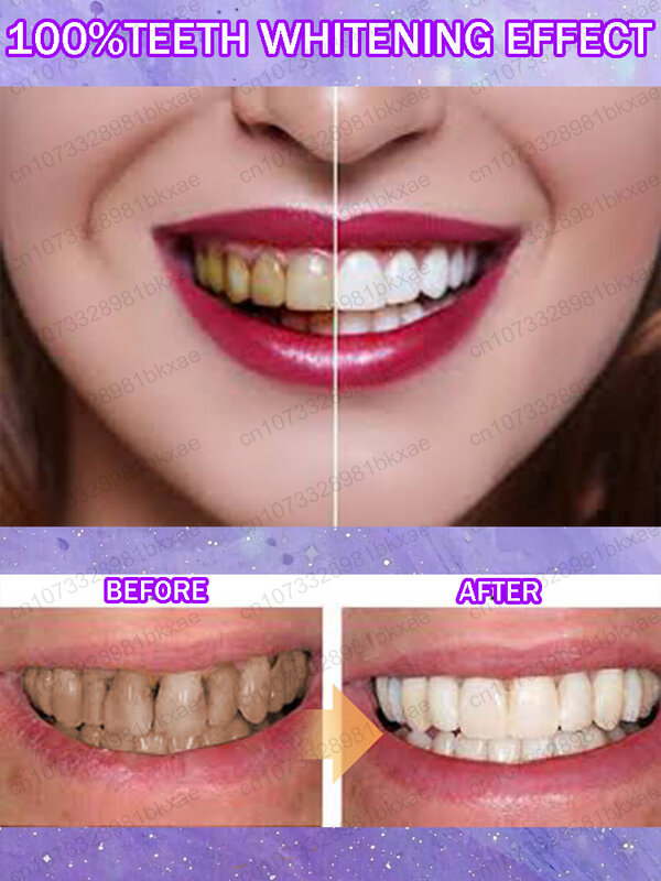 Dentes Whitening Anti-Cavity Restauração Dente, Remove Mau Hálito, Placa, Remove a Cavidade Oral, Dor de Dente, Alivia Placa