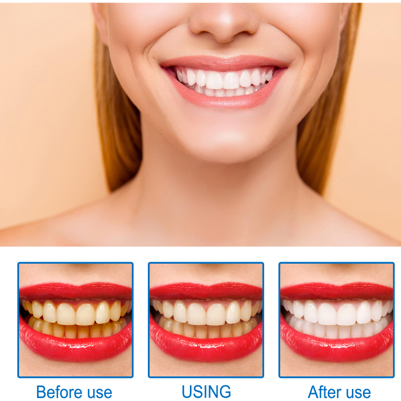 Efficace rimozione contro la carie dentale sbiancamento dei denti essenza placca schiarente denti alito fresco igiene orale pulizia dei denti