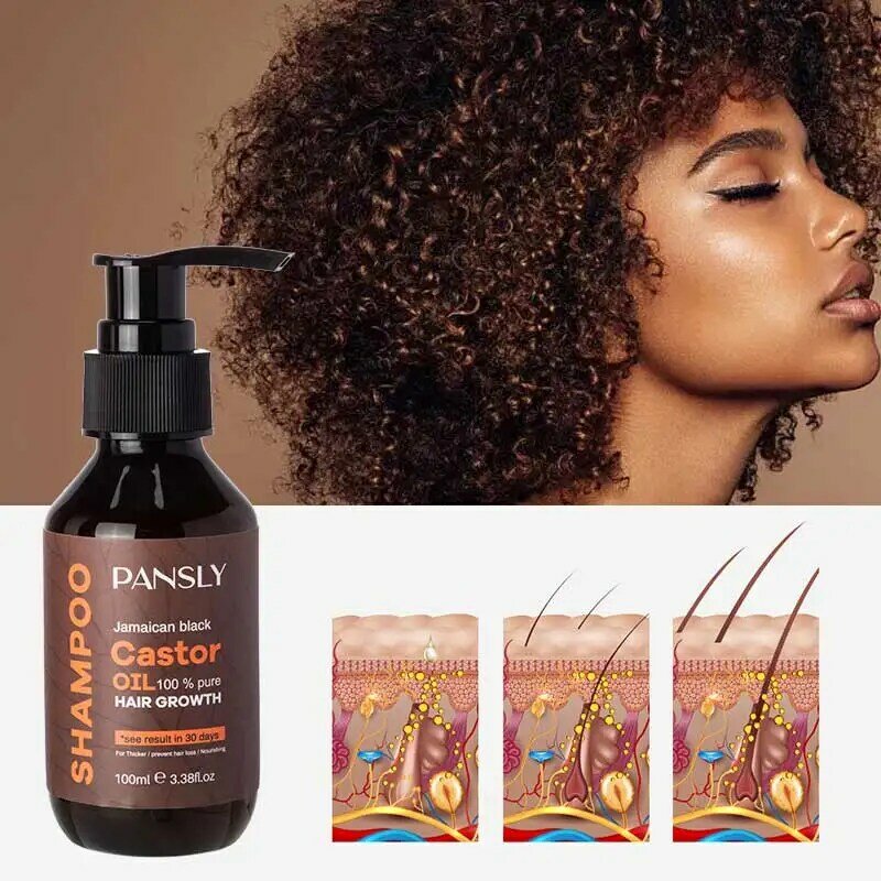 Pansly-champú para el crecimiento del cabello, extracto de jengibre para todo tipo de cabellos, tratamiento para la caída del cabello, productos para el crecimiento del cabello, 100ML