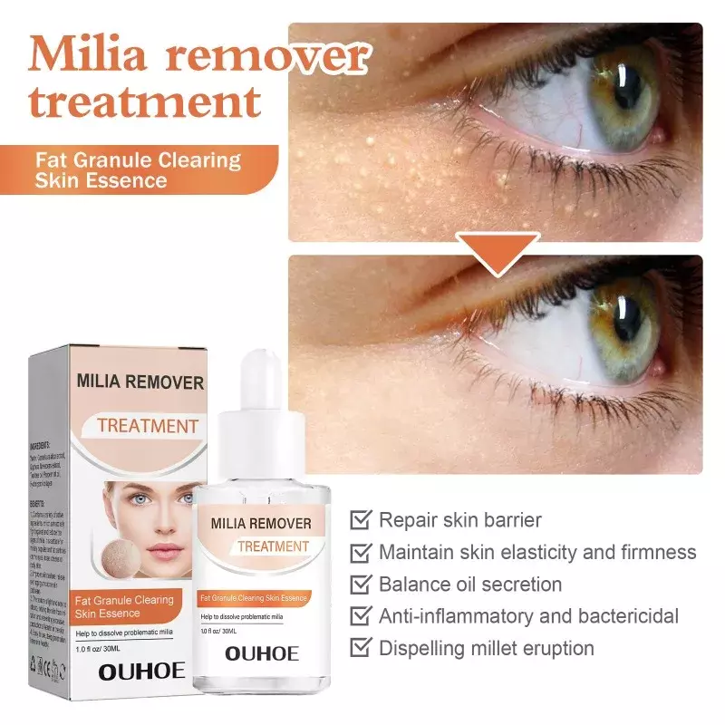 Milia Spot Remover Firming Serum ance repair Fat Granule Milia Spot Eye Bags Dark Circle Anti-Aging Moisturizing Eye Care 30ml