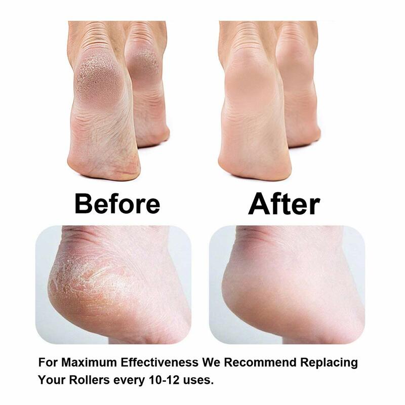Ferramenta de cuidados com os pés cabeças pedicure removedor de pele dura recargas rolos substituição para arquivo ferramenta cuidados com os pés