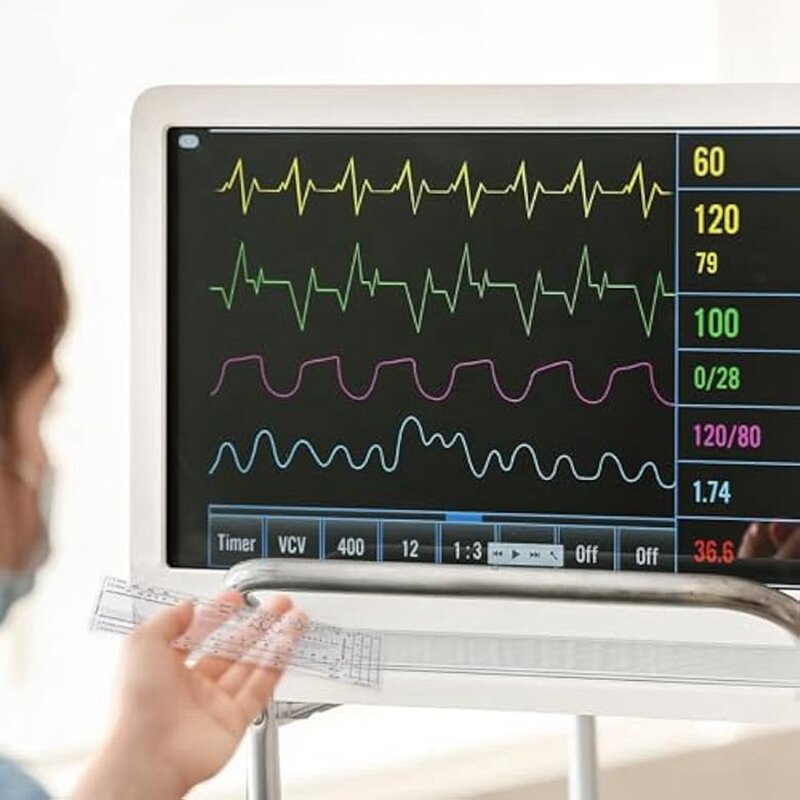 مجموعة أدوات قياس EKG للتمريض ، الفرجار تخطيط القلب المتين ، المسطرة وصياغة مقسم كهربائي للقلب