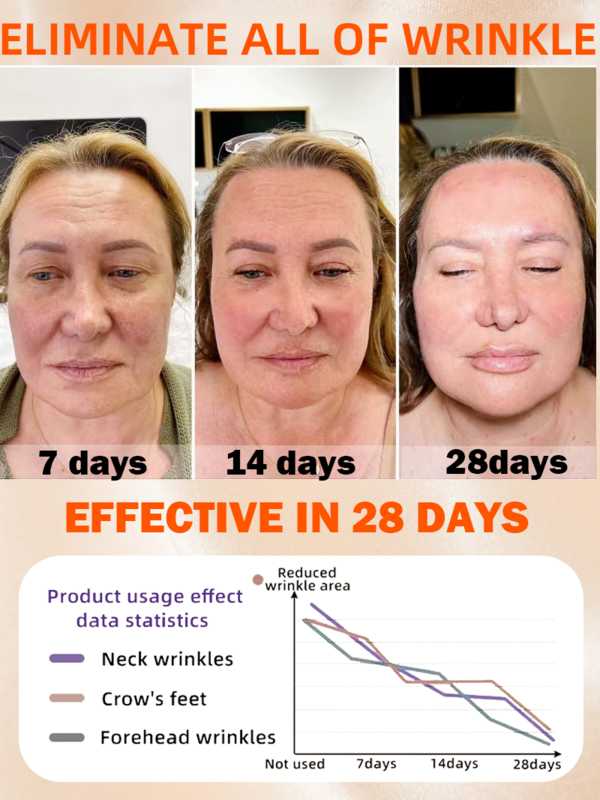 anti aging serum wrinkles removal