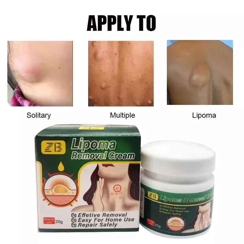 4pcs Care Cream Lipolysis Fat Lump Relief Plaster Anti-Tumor Skin Swelling Remove Cellulite Chinese Herbs Plaster