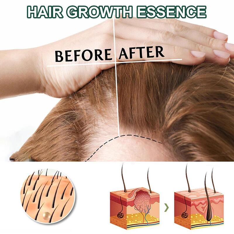 1/2/3/5 buah Serum jahe alami Anti rambut rontok Serum mencegah perawatan kebotakan cepat tumbuh perawatan rambut rusak