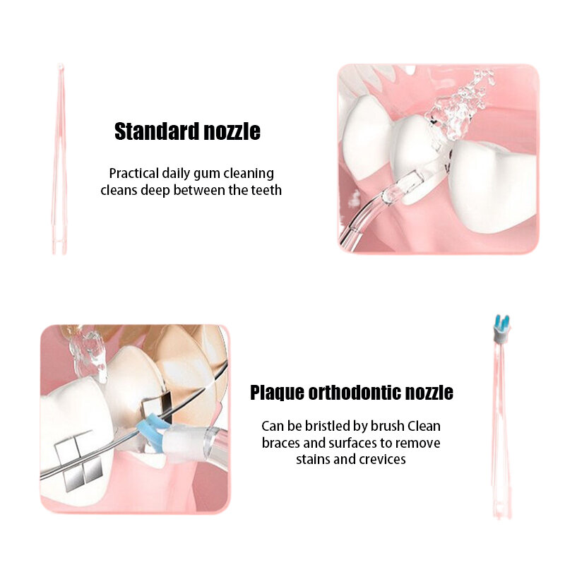 4 Pcs/Set Replaceable Oral Dental Nozzles For Oral Irrigator Dental Water Jet Mouthwash Flosser