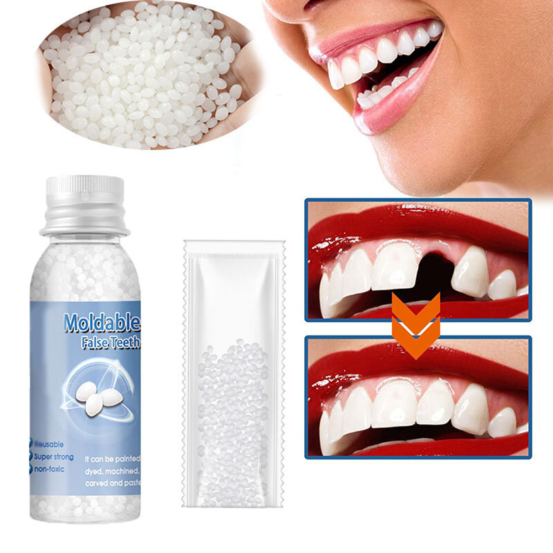 Colle de réparation de dents en résine, colle solide pour le remplissage des espaces de dents saillants, réparation temporaire des dents, colle pour fausses dents, fournitures dentaires de sécurité