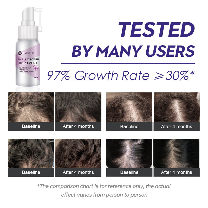 Hair Growth Spray Fast Hair Grow Essential Oil for Men/Women Hair Care Products Anti Hair Loss Treatment Beauty Scalp Treatment
