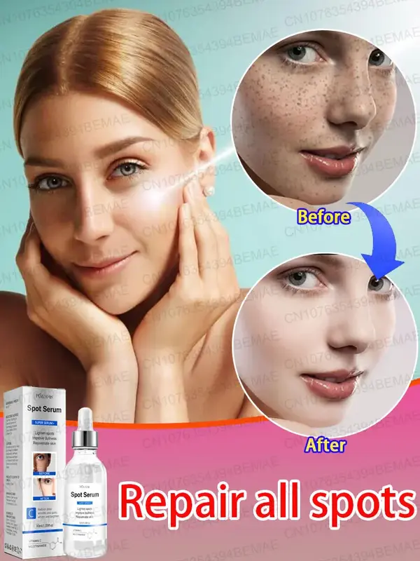 Whitening and anti-freckle essence, remove freckles, moisturize