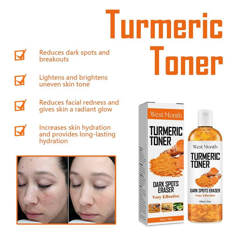 2 Stück Kurkuma Toner 200ml Dark Spot Korrektor Toner für Frauen Gesicht feuchtigkeit spendenden Toner aufhellen Hautton natürliche Formel