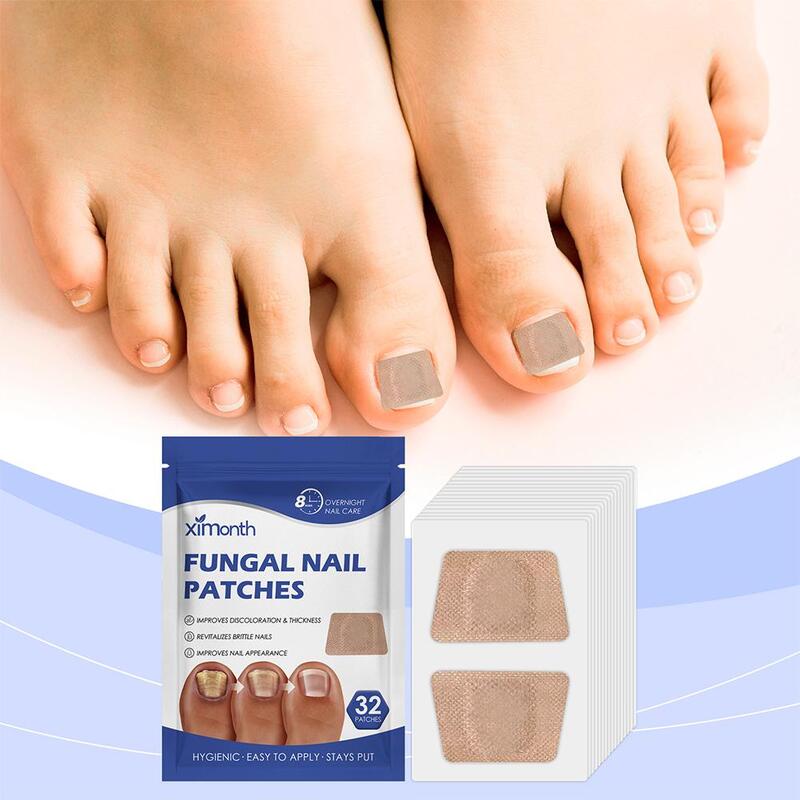 32 Patch/confezione di toppe per funghi dell'unghia del piede toppe appiccicose per la riparazione delle unghie adesivi per la correzione incarnita delle unghie per unghie scolorite o danneggiate