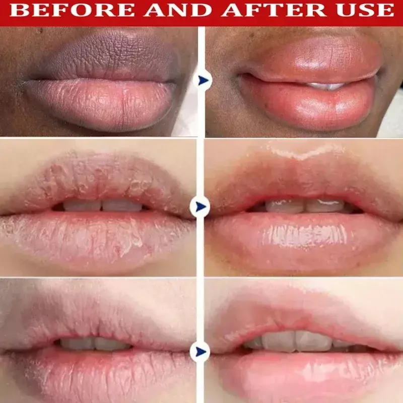 Lip Balm Remove Dark Lighten Melanin Lip Mask Fade Lip Line Brighten Exfoliating Moisturize Dead Skin Repair Lip Care New