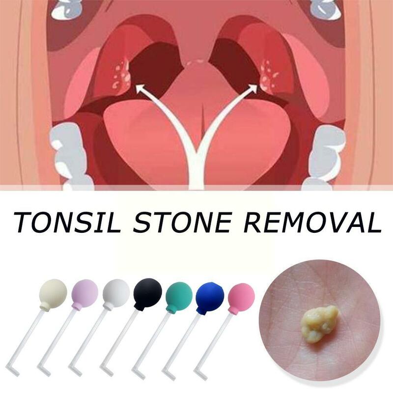 Tonsil alat penghilang batu Manual L0Z9, alat perawatan pembersih mulut penghapus Tonsil, batu lilin L0Z9