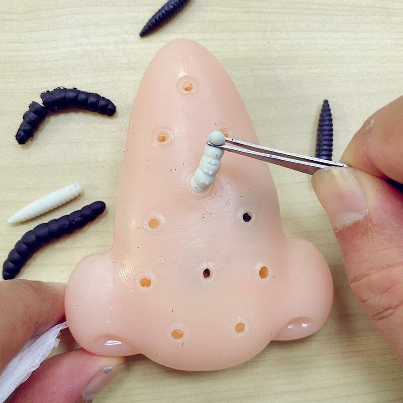 Espinha popping blackheads removedor brinquedo engraçado acne espremendo truque jogo ansiedade alívio descompressão brinquedos