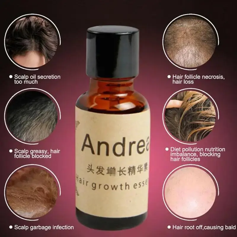 Huile Essentielle-Aceites Esenciales para el crecimiento del cabello, líquido para la pérdida de cabello, restauración pilatoria, denso, ráfaga solar rápida, Andrea, 20ml