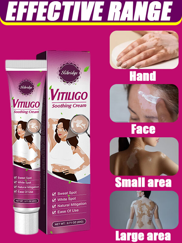 Vitiligo Crème