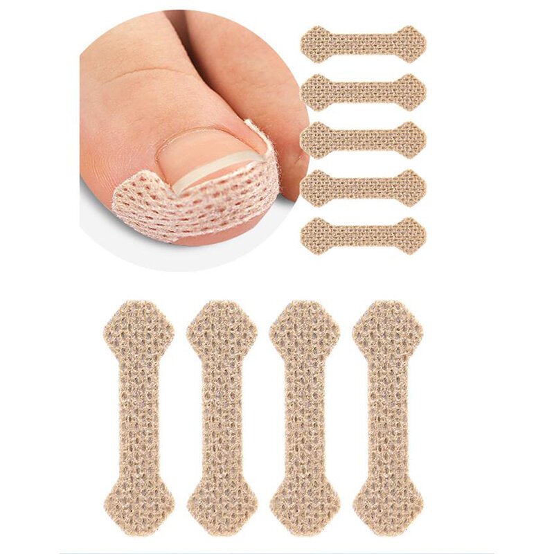 Nail Patches For Treating Paronychia With Nail Correctors And Fixing Devices To Restore Bunion Foot Care