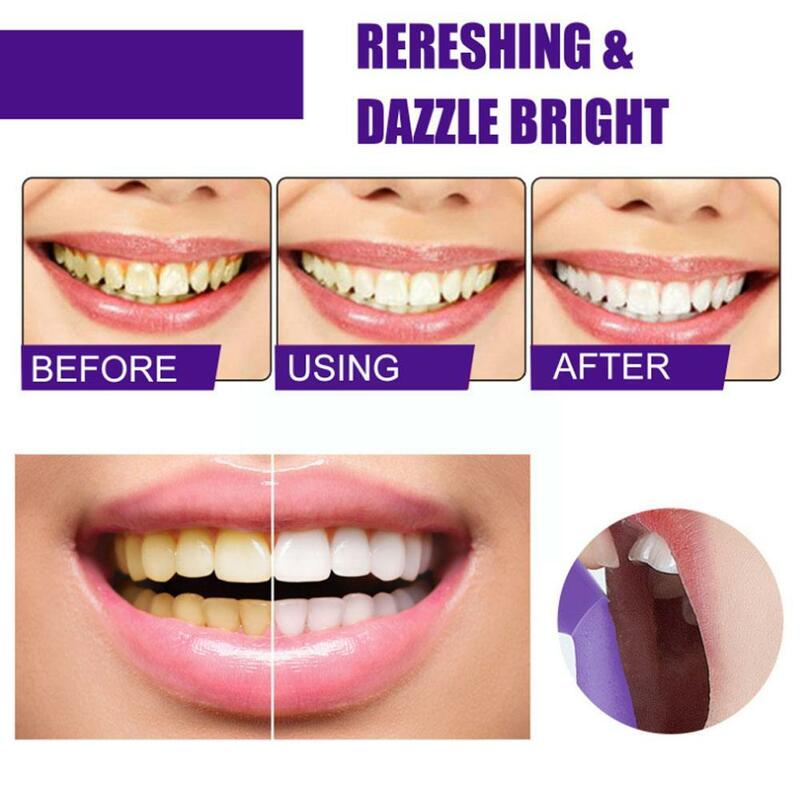 V34ทำความสะอาดฟัน Whitening Mousse ขจัดคราบ Whitening Oral Mousse ฟันและ50Ml ย้อมสีสุขอนามัยยาสีฟันขาว L2F3