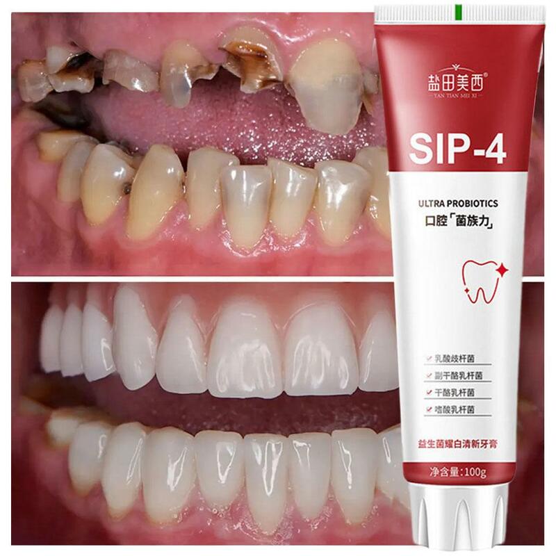 Pasta gigi Sp-4, 1/2/3/5 buah Sip-4 100g pasta gigi probiotik mencerahkan & noda segar memutihkan gigi