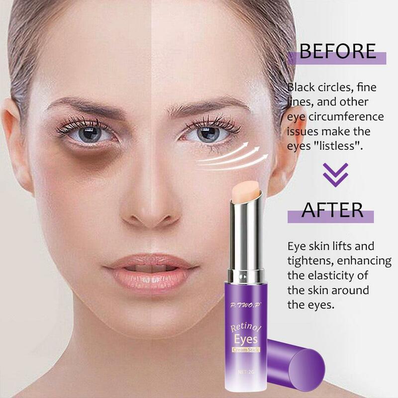 Retinol Eye Cream Stick, círculos escuros, removedor de sacos oculares, cuidados finos, reduz linhas, pele hidratante, anti-inchaço, anti-wri, S4w5