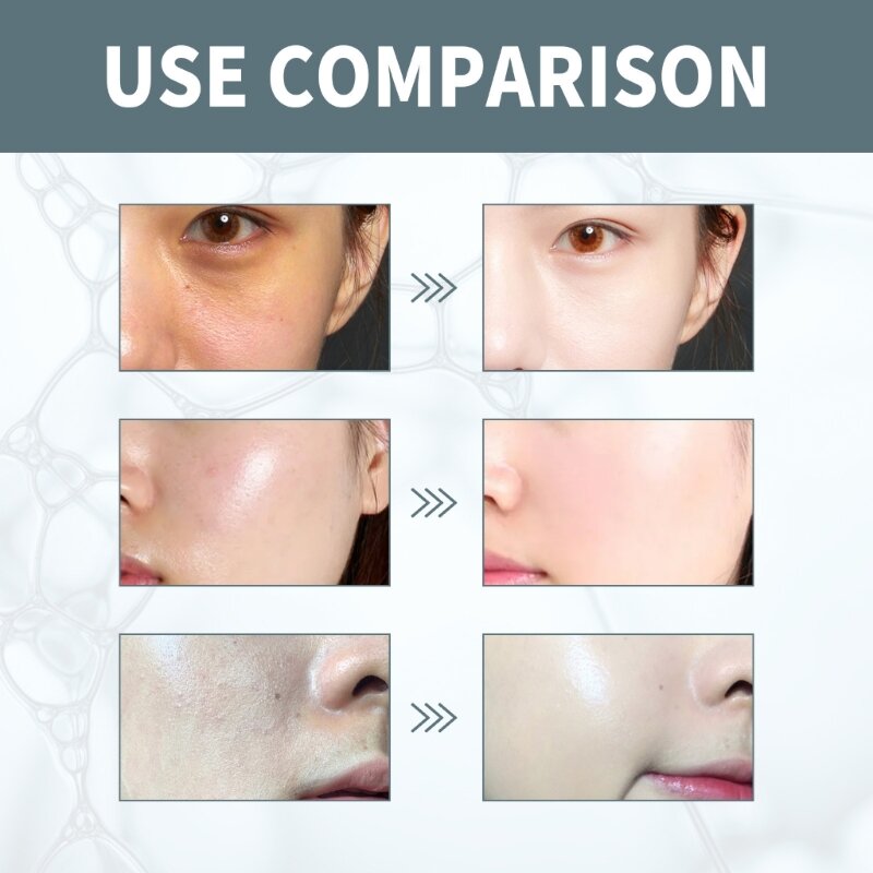 Serum esencją kwasu hialuronowego pielęgnacja skóry twarzy Serum do twarzy redukuj zmarszczki delikatna esencja do twarzy 35ml