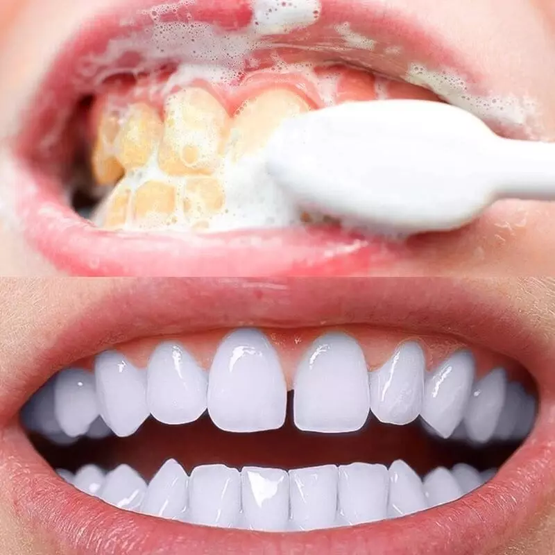 Polvo de limpieza dental, elimina manchas amarillas en los dientes, café, té, vino, para fumar, higiene bucal, 70g
