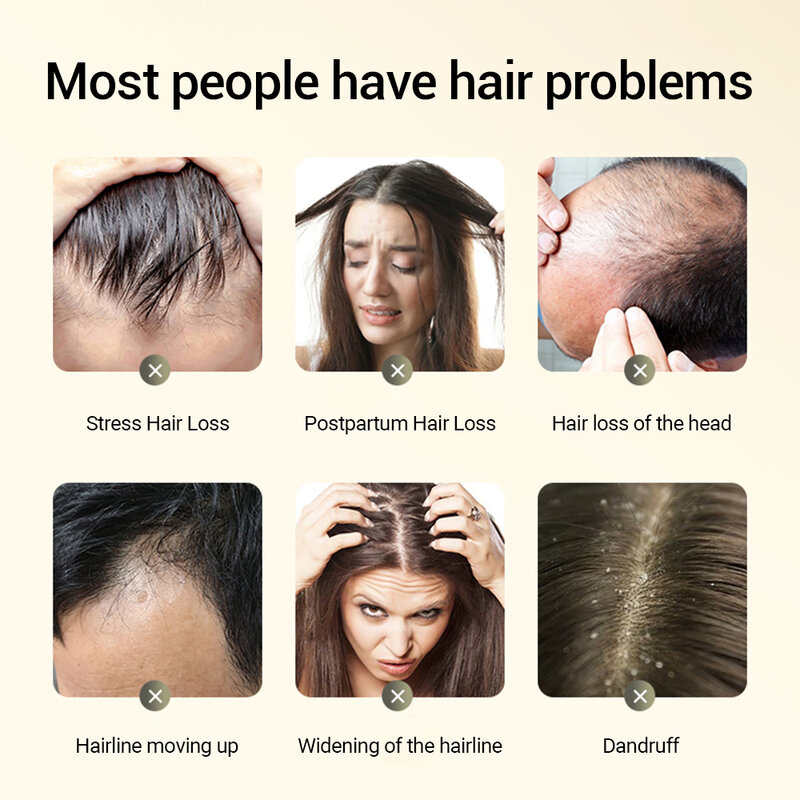 Sampo perawatan rambut, ekstrak tanaman jahe Anti rambut rontok perawatan rambut nutrisi dalam alami memperbaiki rambut gelap 10 buah/boks