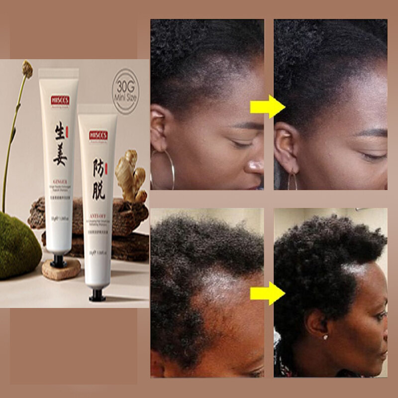 Ancient Secret-champú para el crecimiento del cabello, tratamiento Anti pérdida de cabello, crecimiento salvaje, se puede usar para la calvicie