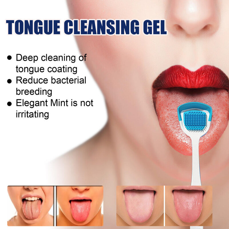 Gel de limpeza de língua com escova, higiene bucal, remover o mau hálito, hálito fresco, bpa livre, para mulher e homem