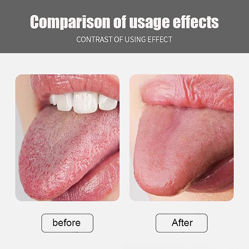 Aço inoxidável Tongue Revestimento Cleaner, Oral Care Tool, Removendo Mau Hálito, Raspador, Cleaner, 1Pc