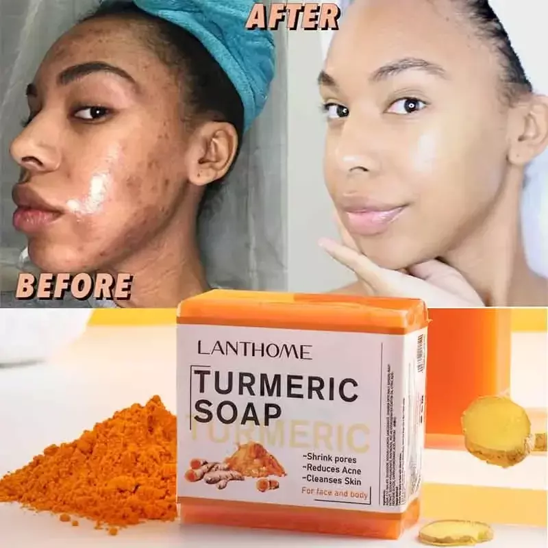 Turcuma Regina-Nettoyant pour le visage, anti-acné, éclaircissant la peau, élimine les boutons, les taches sombres, éclaircissant, fait à la main, vidéo