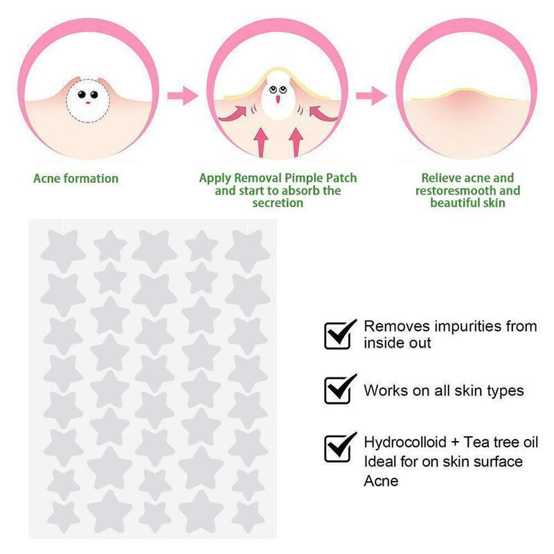 200pcs/set Invisible Acne Pimple Patch Professional Face Skin Care Repair Acne Healing Absorbing Spot Sticker For Men Women