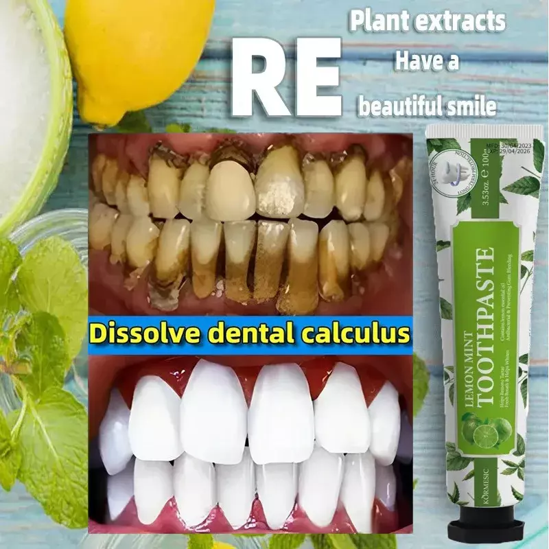 Tandpasta Remover Tandheelkundige Calculus Verwijderen Gele Tanden Slechte Adem Reinigen Tandplak Bleken Voorkomen Parodontitis