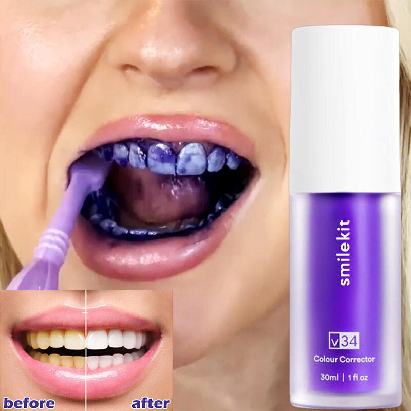 Smilekit-歯のホワイトニング歯磨き粉,白い歯の修理,明るい,歯のケア,紫,減らし,v34