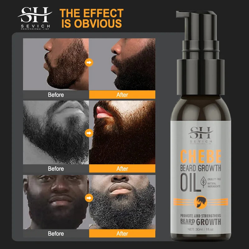 Óleo poderoso do crescimento da barba, nutrição, óleo essencial crescente, tratamento da perda de cabelo, soro, pulverizador, loção