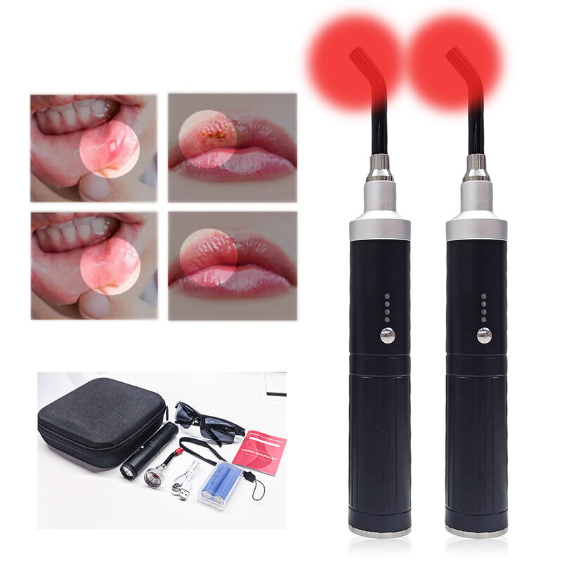 Red Light Device Cold Sore Canker Sore Relief Infrared Light Wand for Mouth Nose Ear Knee Feet Hand Ankle Sport Pain Home Travel