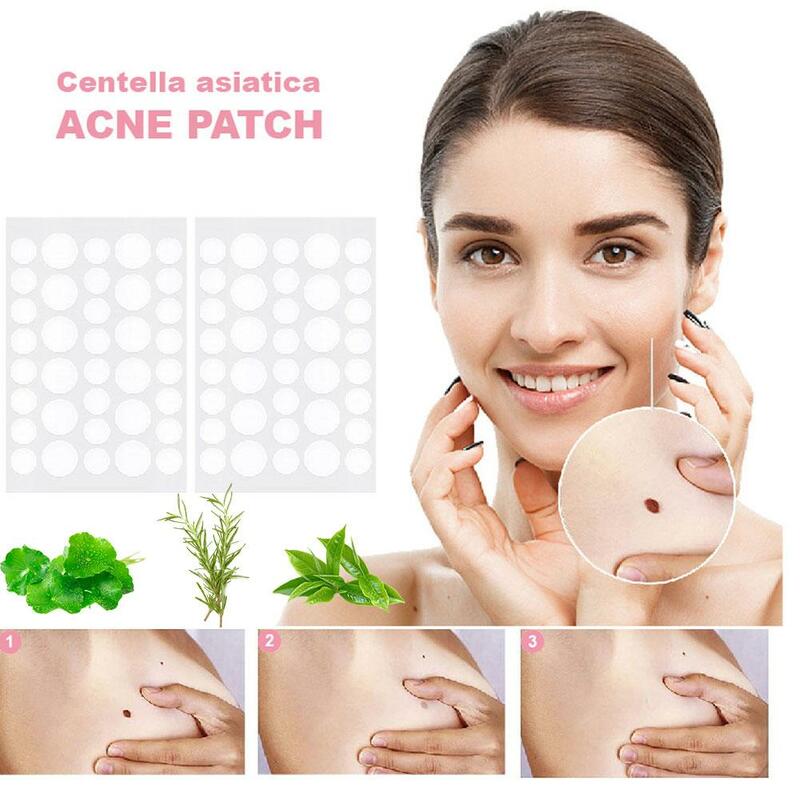 72 Patch Acne brufolo Patch viso adesivi invisibili cura della pelle effetto Acne strumenti per la rimozione del viso Patch rapide trattamento di bellezza L3Q7