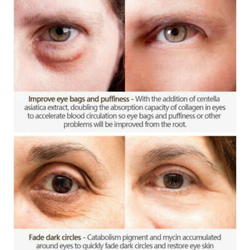 كريم عين الأفوكادو ، الهيالورونيك المرطب ، أكياس مضادة للتجاعيد ، مكافحة الشيخوخة ، مكافحة الشيخوخة ، جزء واحد