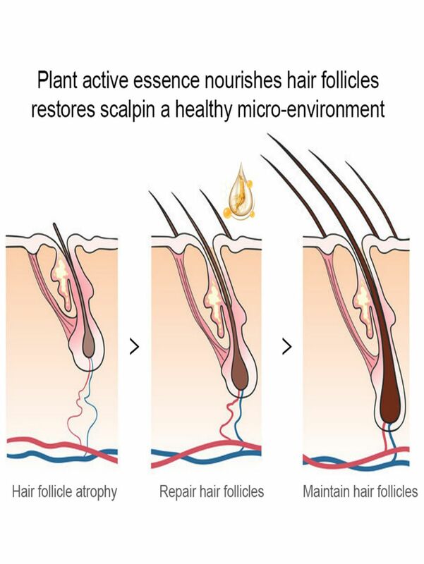 10ml TRSTAY Beard Growth Essence Oil Essential Oils Liquid Hair Grower Oil Hair Maintenance Beard Chest Hair Growth Solution